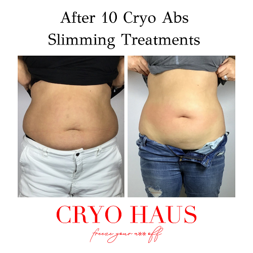 Cryo Slimming :: Non-Invasive Body Contouring Fat Reduction